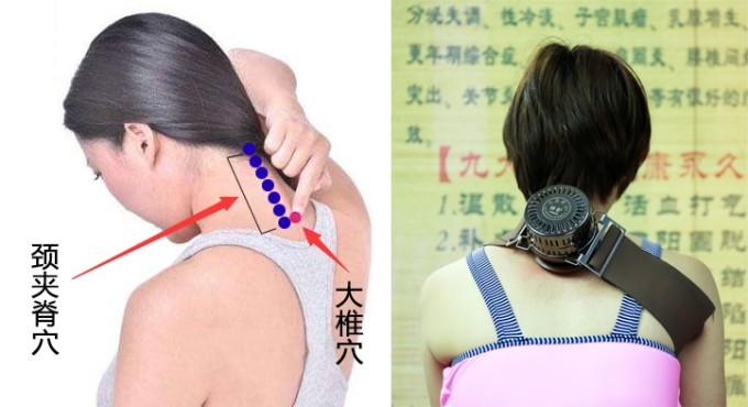 颈夹脊针刺安全深度图片